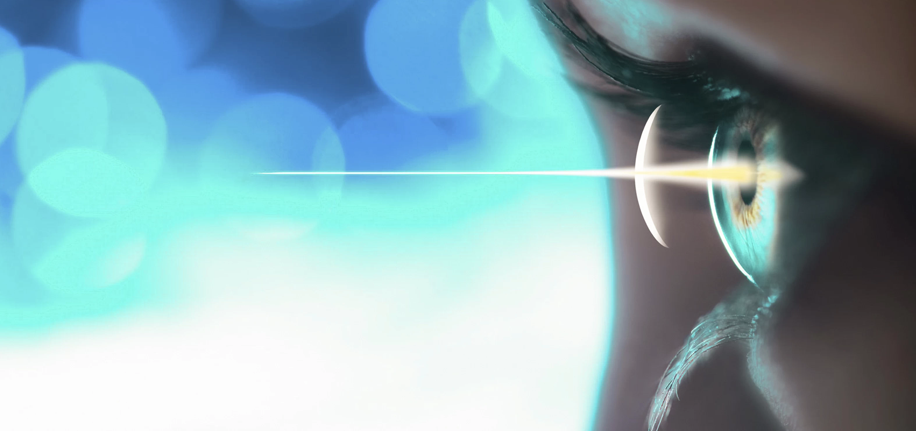 Подготовка к лазерной коррекции зрения